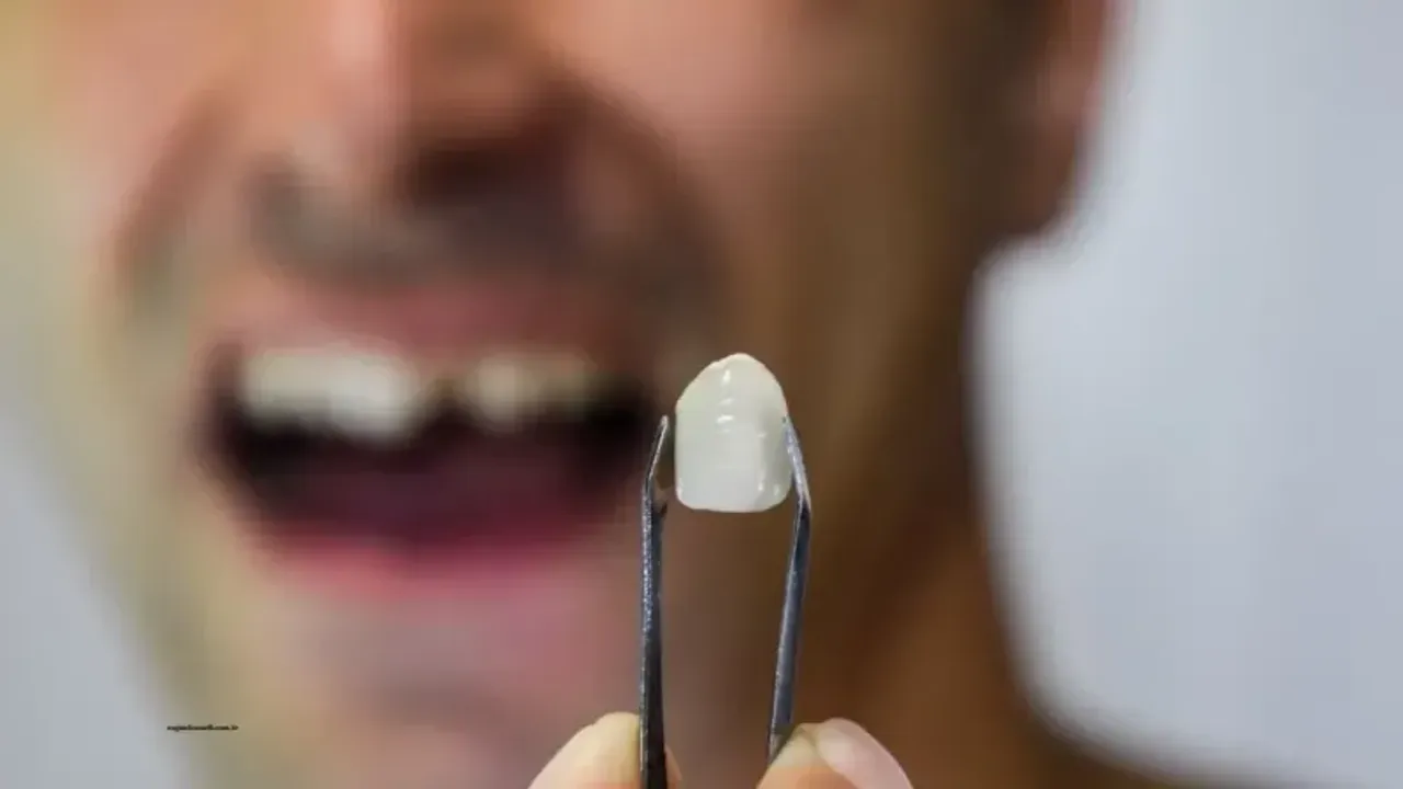 Rüyada Diş Kırılması Nedir, Ne Anlama Gelir?