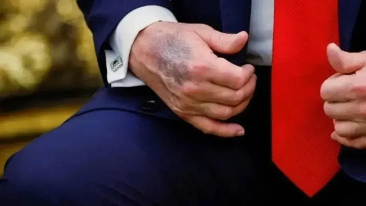 Trump'ın Elindeki Morluklar Gündem Oldu