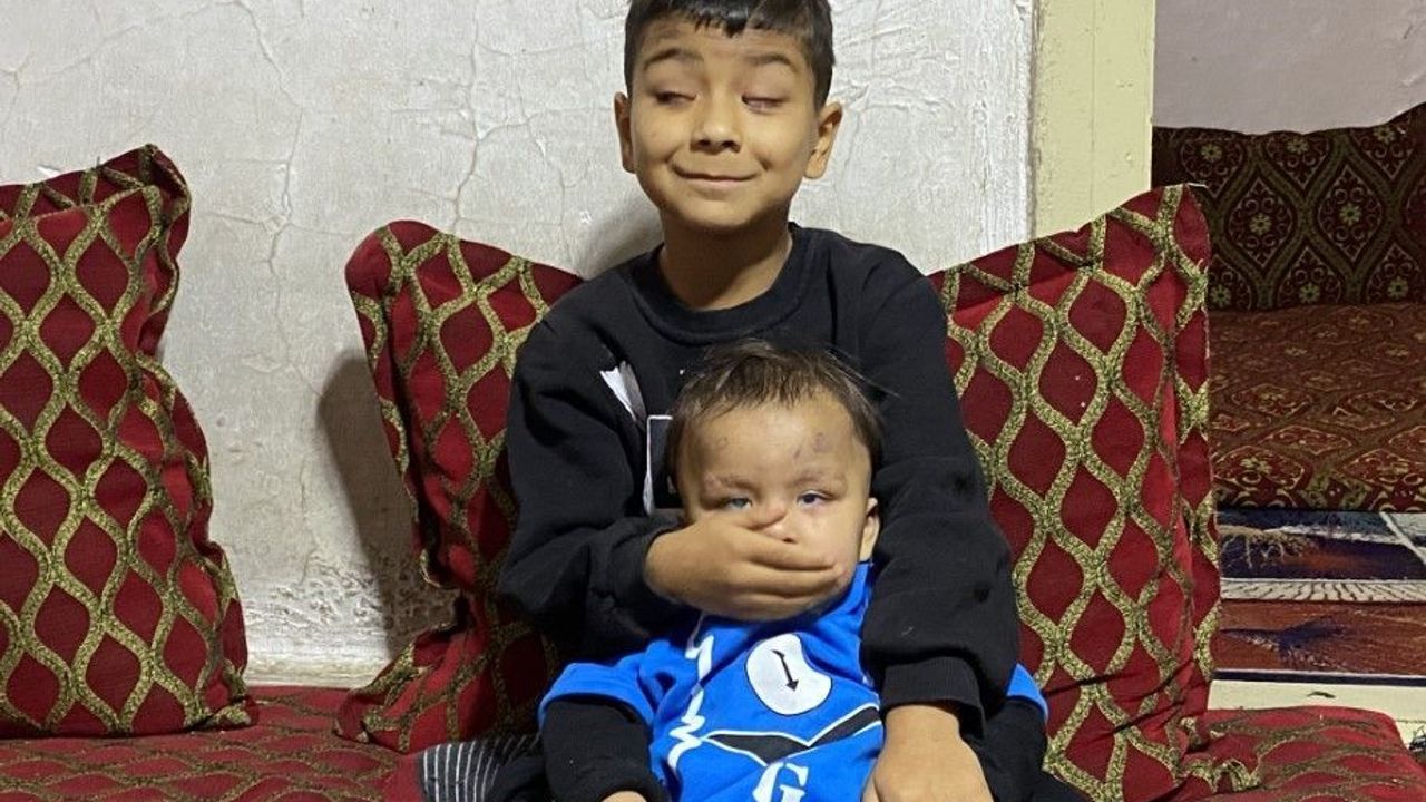 Görme Engelli 2 Kardeş,Dünyayı İlk Kez Gördü!