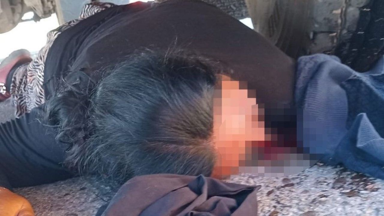 Çöp Kamyonunun Altında Kaldı