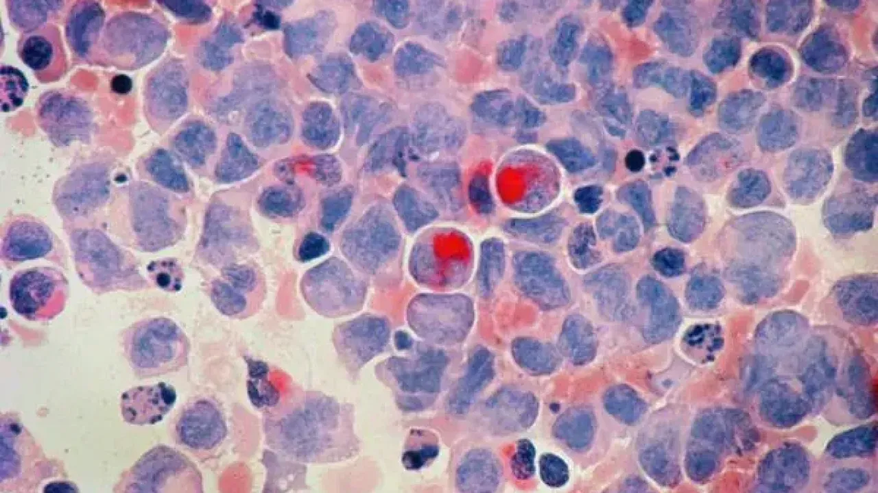 Google’ın yapay zekasından kanser tedavisinde dev adım