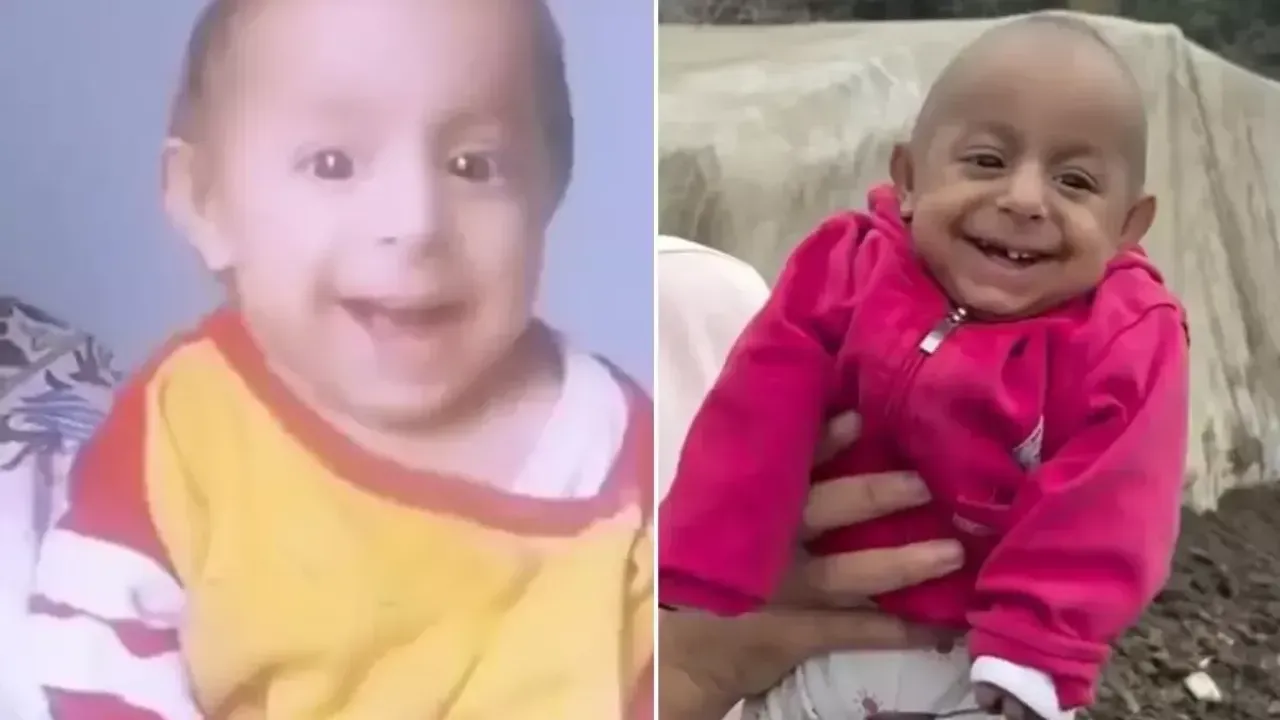 "Gülen Bebek" olarak tanınan Ökkeş Bebek hayatını kaybetti