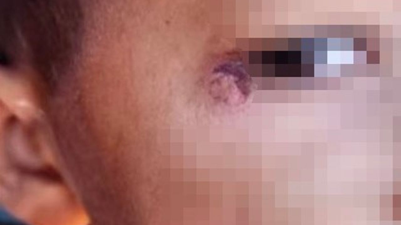 Öğrencinin yüzünde sigara söndürdü!