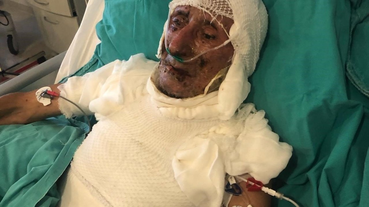 Skandal İddia: Kardeşini Ahıra Kilitleyip Ateşe Verdi