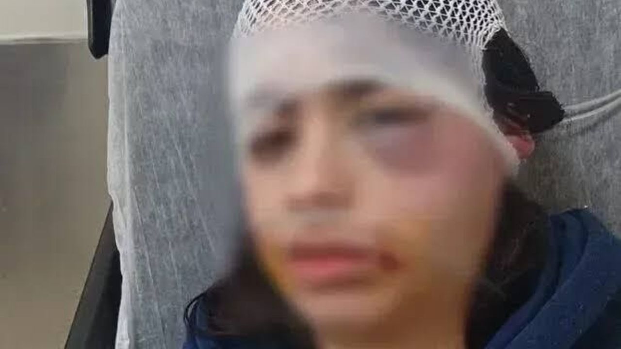 Yeşim Öztürk'ü Öldüresiye Döven Erkek Arkadaşının 