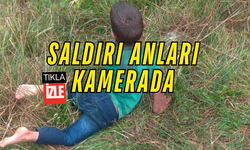 Boğazından Isırılan Çocuk Kocaeli'de Tedavi Altında