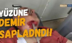 İnşaat İşçisinin Yüzüne Demir Saplandı!