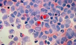 Google’ın yapay zekasından kanser tedavisinde dev adım