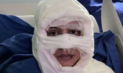 Genç kadın başka bir kadın tarafından ateşe verildi