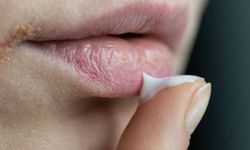 Dikkat! Ağızda başlıyor