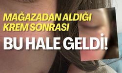 İzmit'te Mağazadan Aldığı Krem Sonrası Yüzü Bu Hale Geldi!