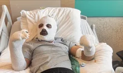 Çay demlerken vücudunun yüzde 26'sı yandı!