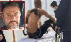 Kamu Binası Önünde Kendini Ateşe Verdi