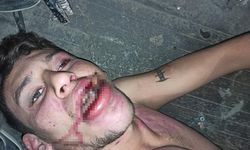 Hamam Böceği Yedirilen Gencin Davasında Karar Çıktı