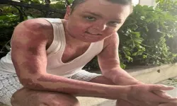 Cayır Cayır Yandı Hayata Tutundu