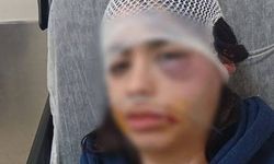 Erkek Arkadaşı Öldüresiye Dövmüştü... “Ölmek istemiyorum”