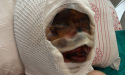 Eşini Koli Bandıyla Bağlayıp Kezzapla Yaktı