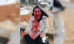 Eşini Kaldırım Taşıyla Dövdü!