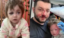 Kucağındaki Bebeğiyle Saldırıya Uğradı!