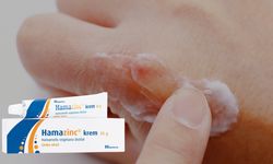 Hamazinc Krem Ne İşe Yarar? Neye İyi Gelir? Fiyatı Ne Kadar?