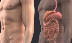 Kasık Fıtığında Modern Cerrahi Dönemi