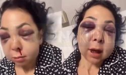 İzmit’te Dehşet: Anne Oğul Mekanda Topluca Darbedildi