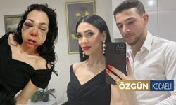 İzmit'te Anne Oğulu Tanınmayacak Hale Getirenler Yakalandı