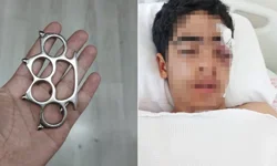 15 Yaşındaki Çocuğun Muştayla Kemiklerini Kırdılar