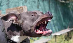 Ünlü Şarkıcıyı Pitbull Parçaladı