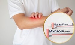 Momecon Krem Ne İşe Yarar? Yan Etkileri ve Kullanımı