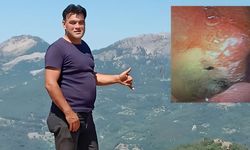 Midesinden Canlı Böcek Çıkarıldı