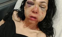 İzmit'te Dövülen Anne Oğulun Davası Görüldü