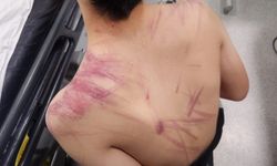 Rehabilitasyon merkezinde darp iddiası: Valilik "hafif yaralandı" dedi, aile darp izlerini paylaştı