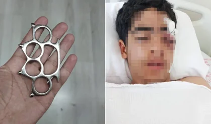 15 Yaşındaki Çocuğun Muştayla Kemiklerini Kırdılar