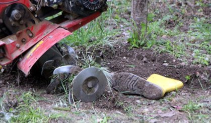 Çapa Makinesine Bacaklarını Kaptırdı!