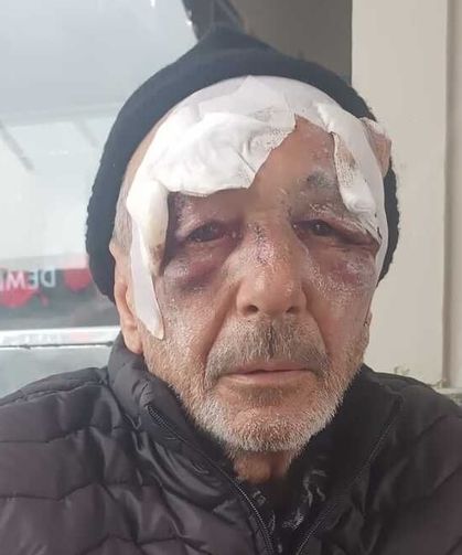 İzmit’te 70 Yaşındaki Adamı Dövdüler!