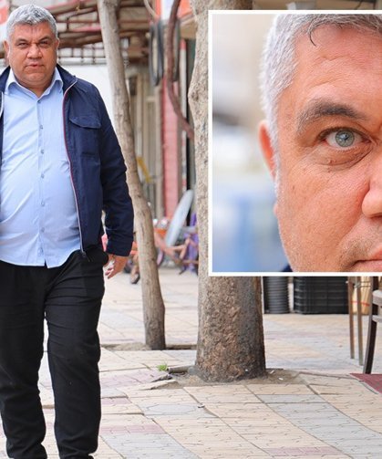 Annesi Farklı Olsun İstemiş: 2 Gözü 3 Rengi Var