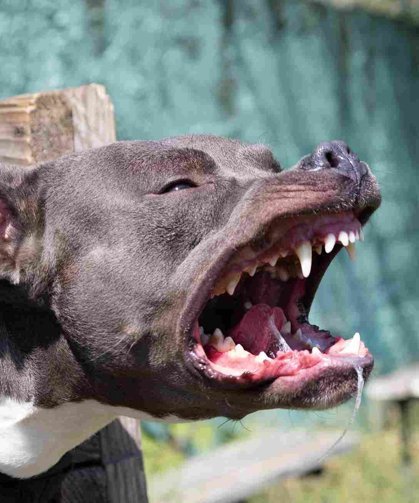 Ünlü Şarkıcıyı Pitbull Parçaladı