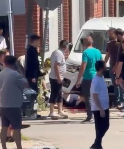 Bacağından Vurdu Ölmesin Diye Turnike Yaptı