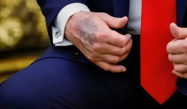 Trump'ın Elindeki Morluklar Gündem Oldu