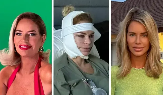 "Yeni Bir Yüz, Yeni Bir Hayat": 20’li Yaşlarda Estetik Çılgınlığı 