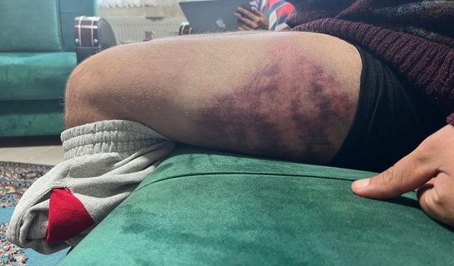 İzmit’te Akılalmaz Şiddet: Otizmli Gence Fırında Dayak!