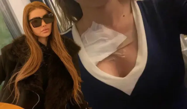 Göğüslerini Yaptıran Fenomenin Çilesi Kocaeli'de Son Buldu