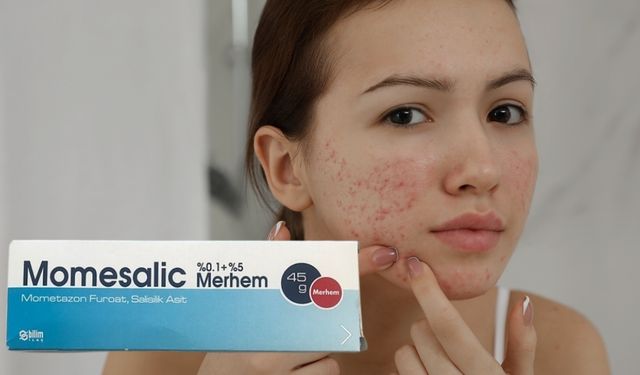 Momesalic Merhem Nedir? Momesalic Merhem Neye Yarar?