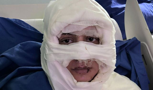 Genç kadın başka bir kadın tarafından ateşe verildi