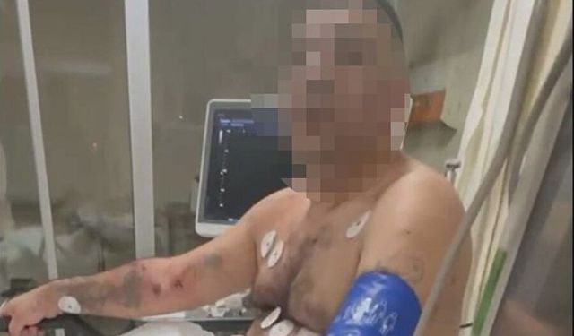 Pompalı Tüfekle Dehşet Saçtı: Biri Polis 4 Yaralı