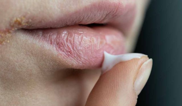 Dikkat! Ağızda başlıyor