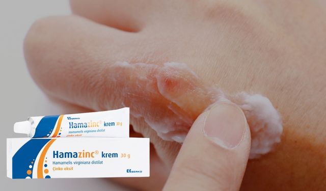 Hamazinc Krem Ne İşe Yarar? Neye İyi Gelir? Fiyatı Ne Kadar?