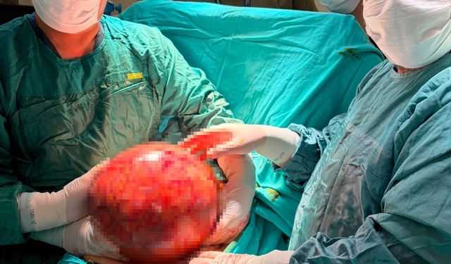 Karnından 6.5 Kiloluk Tümör Çıktı!