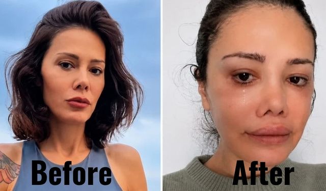 Didem Ceran Kimdir? Kaç Yaşında, Neden Yüz Nakli Oldu?